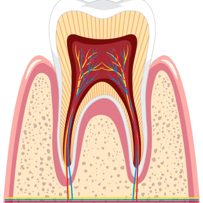 Specialized Re-Root Canal treatment to save previously treated teeth